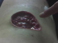 4 inch diameter hole in Carl's side